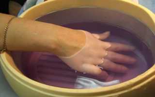 7 основных и множество дополнительных причин онемения рук и пальцев