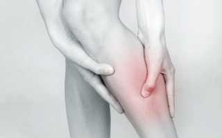 Варикозное расширение вен на ногах: симптомы и лечение, причины и последствия