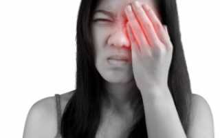 Почему болит голова при движении глаз