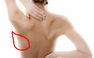 Причины боли под правой лопаткой сзади со спины
