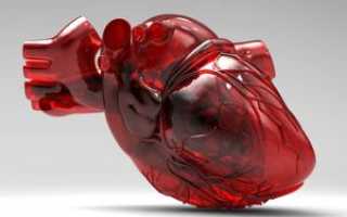 Что такое кардиопатия, ее виды и лечение